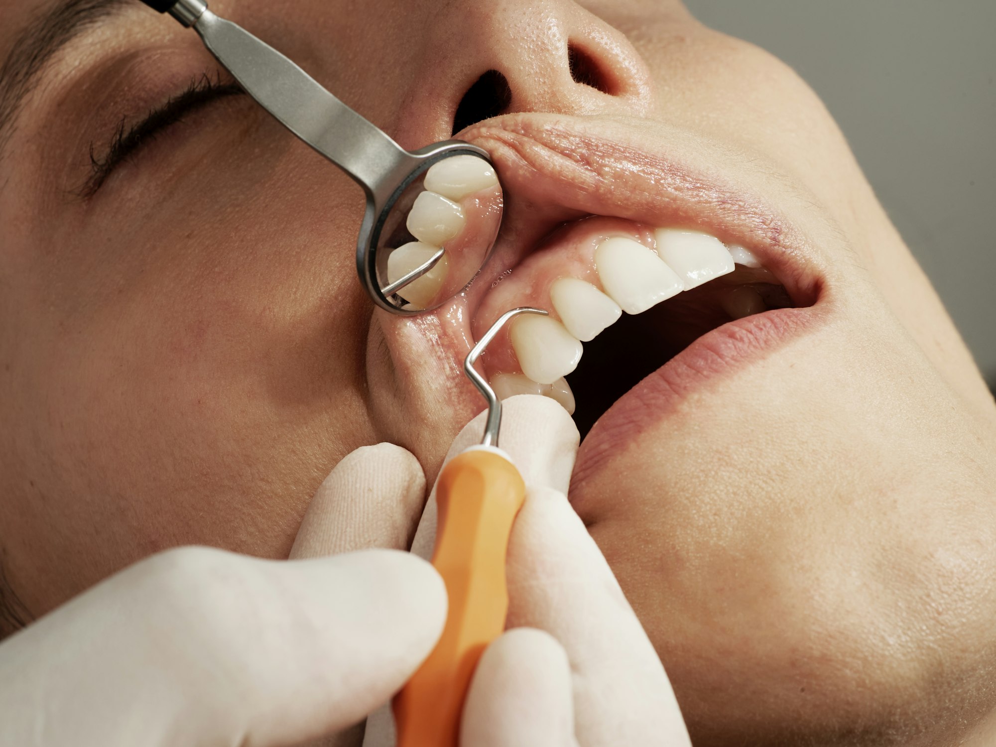 Beautiful smile transformation showcasing cosmetic dentistry results
